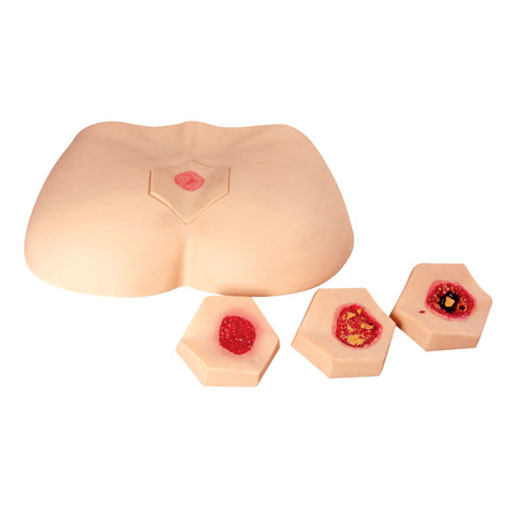 �A���쯏�o��ģ��