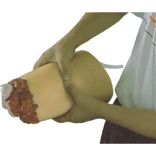 ��֫�����ֹ֫Ѫģ��