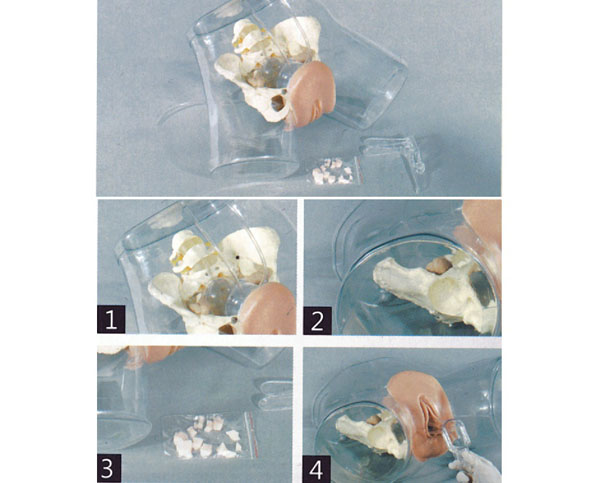 ͸���Όm��ʾģ��