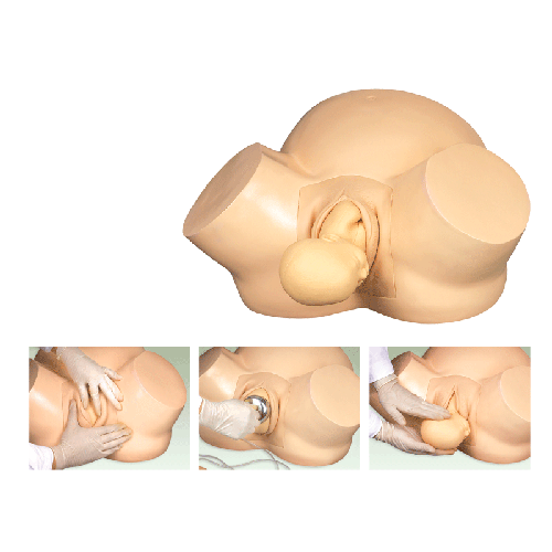 �߼����a(ch��n)Ӗ��ģ��