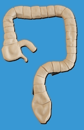 乙狀結(jié)腸鏡檢查模型 乙狀結(jié)腸鏡檢查模型