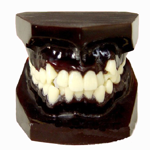 錯(cuò)頜畸形分類演示模型B 錯(cuò)頜畸形分類演示模型B